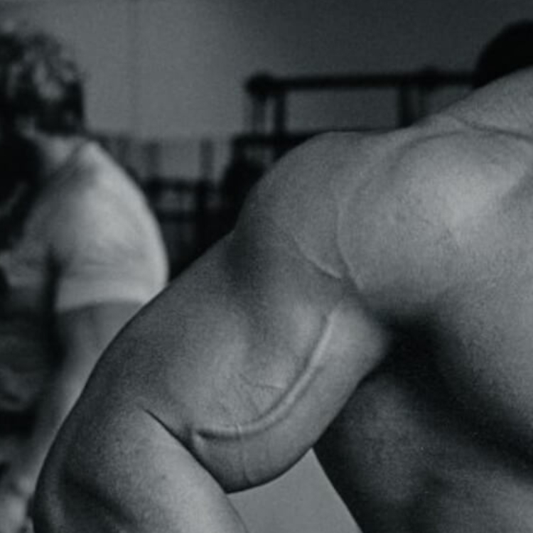 PROTO NFC frame 4 pixes